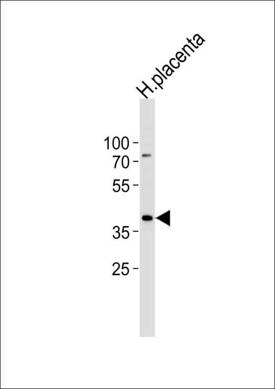 Western blot of lysate from human placenta tissue lysate, using IDH3G Antibody. Antibody was diluted at 1:1000 at each lane. A goat anti-rabbit IgG H&L (HRP) at 1:5000 dilution was used as the secondary antibody. Lysate at 35ug per lane.