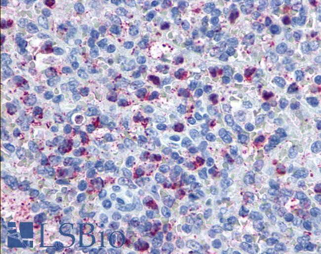 Anti-GPR34 antibody IHC of human spleen. Immunohistochemistry of formalin-fixed, paraffin-embedded tissue after heat-induced antigen retrieval.
