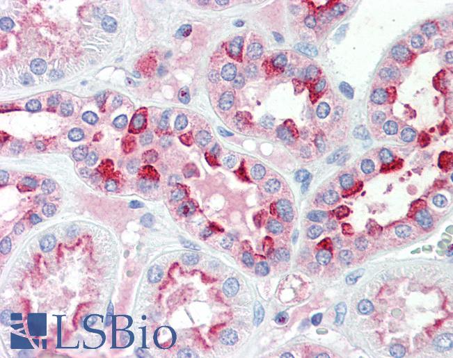 Anti-IDH3G antibody IHC staining of human kidney. Immunohistochemistry of formalin-fixed, paraffin-embedded tissue after heat-induced antigen retrieval. Antibody LS-B9541 concentration 5 ug/ml.