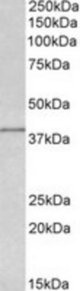 IDH3G antibody (0.5 ug/ml) staining of MCF7 lysate (35 ug protein/ml in RIPA buffer). Primary incubation was 1 hour. Detected by chemiluminescence.
