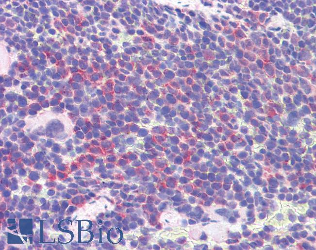 Anti-IDO1 / IDO antibody IHC of mouse spleen. Immunohistochemistry of formalin-fixed, paraffin-embedded tissue after heat-induced antigen retrieval. Antibody LS-B1746 concentration 2.5 ug/ml.