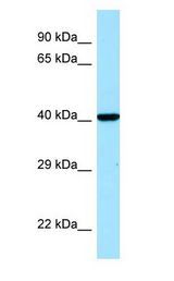 IDO1 / IDO antibody Western Blot of Placenta.