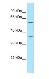 GPR35 antibody Western Blot of HT1080.