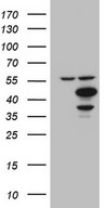 HEK293T cells were transfected with the pCMV6-ENTRY control (Left lane) or pCMV6-ENTRY IDO2 (Right lane) cDNA for 48 hrs and lysed. Equivalent amounts of cell lysates (5 ug per lane) were separated by SDS-PAGE and immunoblotted with anti-IDO2.