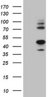 HEK293T cells were transfected with the pCMV6-ENTRY control (Left lane) or pCMV6-ENTRY IDO2 (Right lane) cDNA for 48 hrs and lysed. Equivalent amounts of cell lysates (5 ug per lane) were separated by SDS-PAGE and immunoblotted with anti-IDO2.