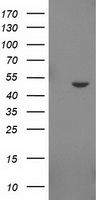 HEK293T cells were transfected with the pCMV6-ENTRY control (Left lane) or pCMV6-ENTRY IDO2 (Right lane) cDNA for 48 hrs and lysed. Equivalent amounts of cell lysates (5 ug per lane) were separated by SDS-PAGE and immunoblotted with anti-IDO2.