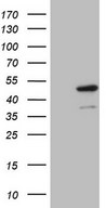 HEK293T cells were transfected with the pCMV6-ENTRY control (Left lane) or pCMV6-ENTRY IDO2 (Right lane) cDNA for 48 hrs and lysed. Equivalent amounts of cell lysates (5 ug per lane) were separated by SDS-PAGE and immunoblotted with anti-IDO2.