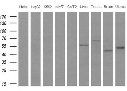 Western blot of extracts (10ug) from 5 different cell lines and 4 human tissue by using anti-IDO2 monoclonal antibody (1: HeLa; 2: HepG2; 3: K562; 4: Mcf7; 5: SVT2; 6: Liver; 7: Testis; 8: Brain; 9: Uterus) at 1:200 dilution.