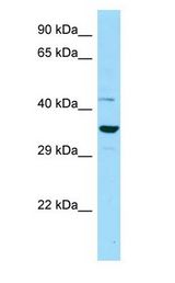 IDO2 antibody Western Blot of OVCAR-3.