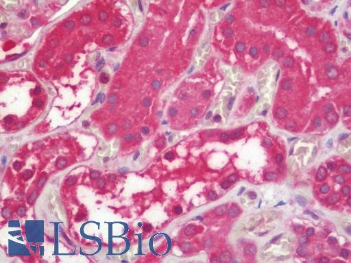 Anti-IDS antibody IHC staining of human kidney. Immunohistochemistry of formalin-fixed, paraffin-embedded tissue after heat-induced antigen retrieval. Antibody LS-B11203 concentration 10 ug/ml.