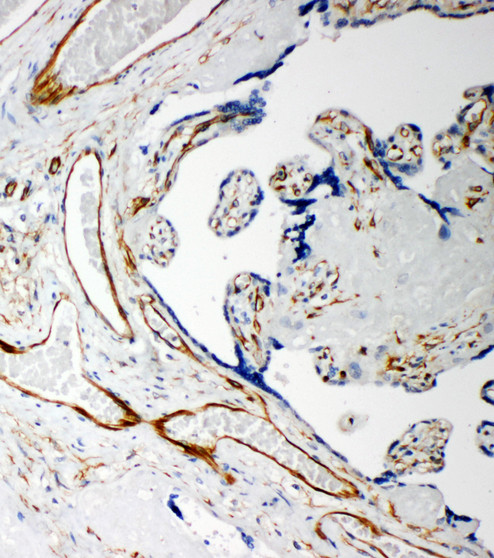 IDS antibody. IHC(P): Human Placenta Tissue.