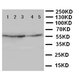 WB of IDS antibody. Lane 1: HELA Cell Lysate. Lane 2: SMMC Cell Lysate. Lane 3: A549 Cell Lysate. Lane 4: MCF-7 Cell Lysate. Lane 5: COLO Cell Lysate.