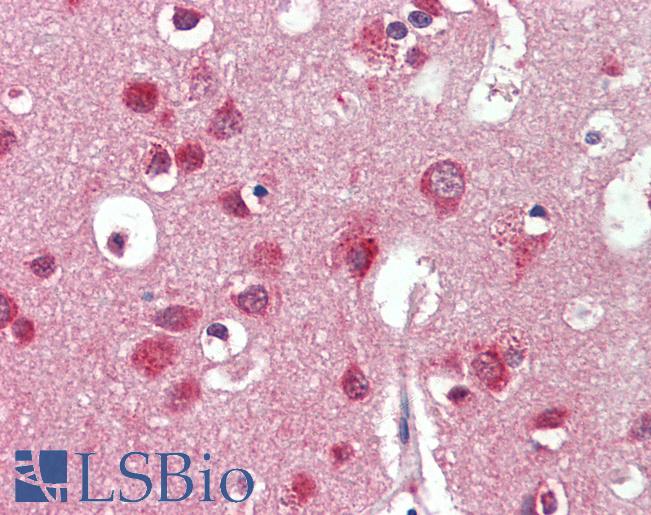 Anti-IDS antibody IHC staining of human brain, cortex. Immunohistochemistry of formalin-fixed, paraffin-embedded tissue after heat-induced antigen retrieval. Antibody LS-B11028 concentration 10 ug/ml.