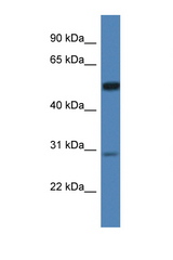 IDS antibody Western blot of HeLa Cell lysate. Antibody concentration 1 ug/ml.