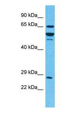 Western blot of IDUA Antibody with human 293T Whole Cell lysate.