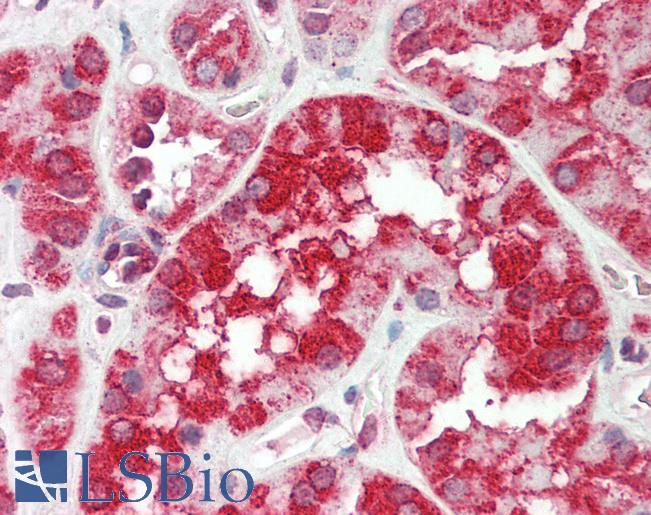 Human Kidney: Formalin-Fixed, Paraffin-Embedded (FFPE)