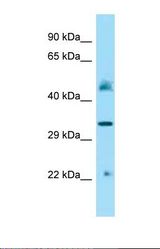 Western blot of Mouse Kidney lysate. IDUA antibody dilution 1.0 ug/ml.