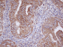 IHC of paraffin-embedded Human endometrium tissue using anti-MTIF3 mouse monoclonal antibody. (Heat-induced epitope retrieval by 10mM citric buffer, pH6.0, 100C for 10min).