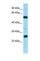 GPR37L1 antibody LS-C146300 Western blot of Fetal Brain lysate. Antibody concentration 1 ug/ml.