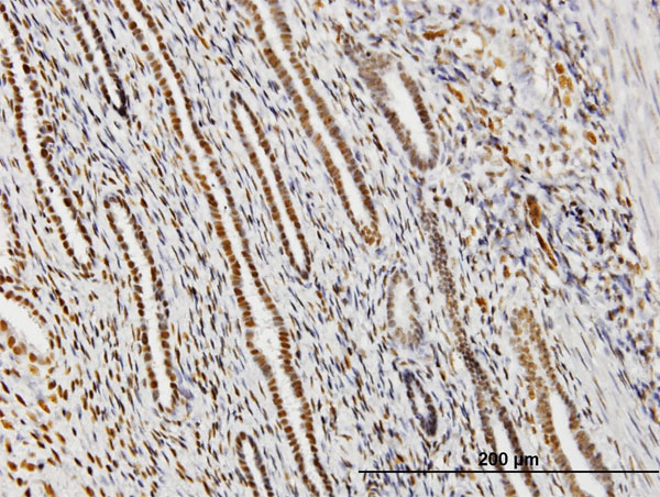 Immunoperoxidase of monoclonal antibody to IFI16 on formalin-fixed paraffin-embedded human endometrium. [antibody concentration 3 ug/ml]