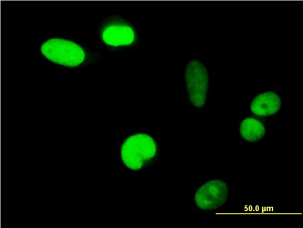 Immunofluorescence of monoclonal antibody to IFI16 on HeLa cell. [antibody concentration 10 ug/ml]