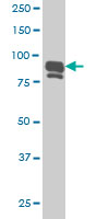 IFI16 monoclonal antibody (M02), clone 2C2 Western blot of IFI16 expression in HeLa NE.