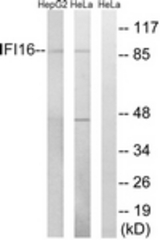 Western blot of extracts from HeLa/HepG2 cells, using IFI16 Antibody. The lane on the right is treated with the synthesized peptide.
