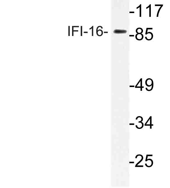 Western blot of IFI-16 (N772) pAb in extracts from HepG2 cells.