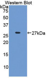 Western blot of recombinant IFI16.