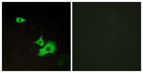 Immunofluorescence of LOVO cells, using ETBR2 Antibody. The picture on the right is treated with the synthesized peptide.