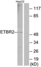 Western blot of extracts from HepG2 cells, using ETBR2 Antibody. The lane on the right is treated with the synthesized peptide.