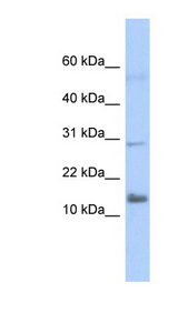 IFI27L2 / FAM14A antibody LS-C111249 Western blot of Transfected 293T cell lysate.