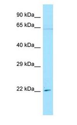 IFI30 / IP30 antibody Western Blot of HeLa.