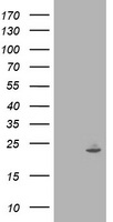 HEK293T cells were transfected with the pCMV6-ENTRY control (Left lane) or pCMV6-ENTRY IFI35 (Right lane) cDNA for 48 hrs and lysed. Equivalent amounts of cell lysates (5 ug per lane) were separated by SDS-PAGE and immunoblotted with anti-IFI35.