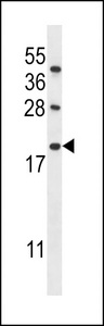 IFI6 Antibody western blot of MDA-MB453,CEM cell line lysates (35 ug/lane). The IFI6 antibody detected the IFI6 protein (arrow).