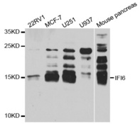 Western blot analysis of extracts of various cell lines, using IFI6 antibody.