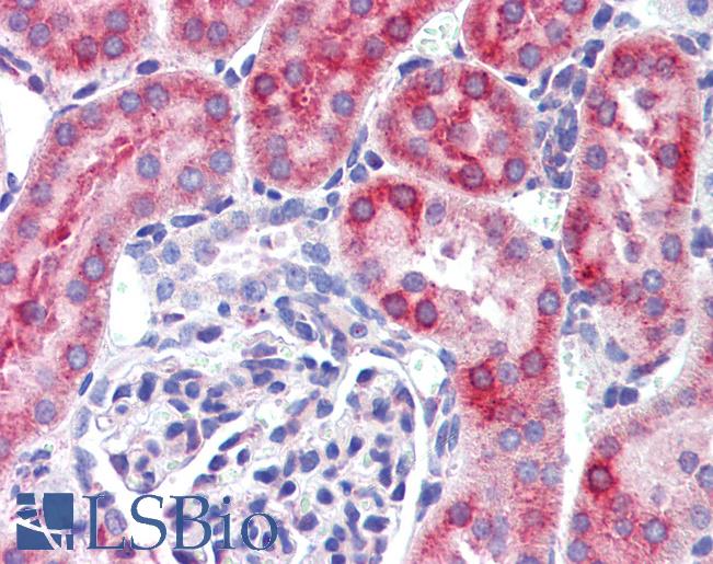 Anti-MDA5 antibody IHC of mouse kidney. Immunohistochemistry of formalin-fixed, paraffin-embedded tissue after heat-induced antigen retrieval. Antibody LS-B2107 concentration 5 ug/ml.