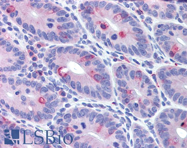 Anti-MDA5 antibody IHC of mouse small intestine. Immunohistochemistry of formalin-fixed, paraffin-embedded tissue after heat-induced antigen retrieval. Antibody LS-B2107 concentration 5 ug/ml.