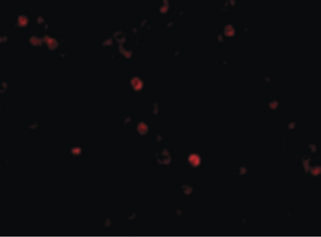 Immunofluorescence of MDA5 in Human Lymph Node cells with MDA5 antibody at 20 ug/ml.