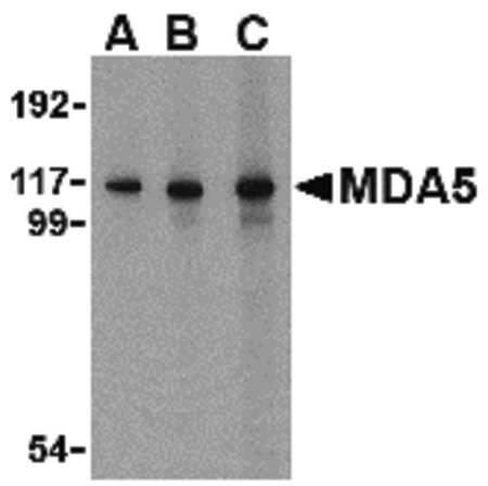Western blot of MDA5 in Daudi cell lysate with MDA5 antibody at (A) 1, (B) 2 and (C) 4 ug/ml.