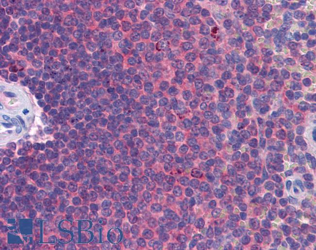 Anti-MDA5 antibody IHC of human spleen. Immunohistochemistry of formalin-fixed, paraffin-embedded tissue after heat-induced antigen retrieval. Antibody LS-B5622 concentration 5 ug/ml.