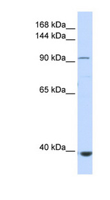 IFIH1 / MDA5 antibody LS-B5622 Western blot of Fetal Muscle lysate.