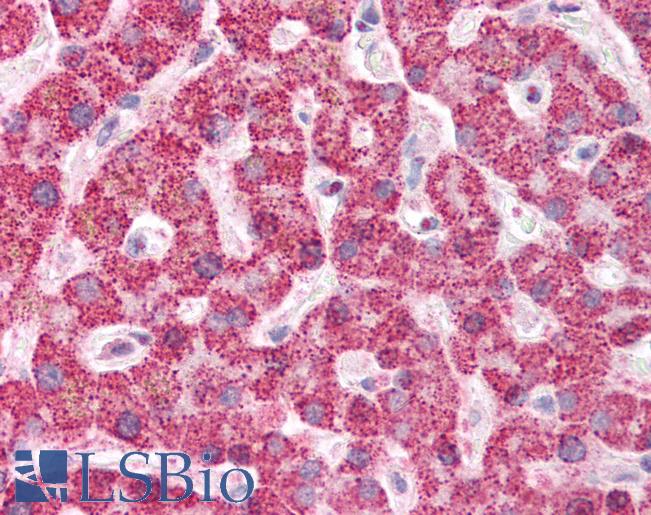 Anti-MDA5 antibody IHC of human liver. Immunohistochemistry of formalin-fixed, paraffin-embedded tissue after heat-induced antigen retrieval. Antibody LS-B2349 concentration 5 ug/ml.