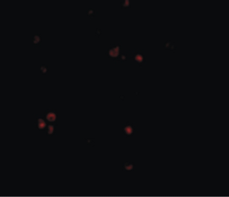 Immunofluorescence of MDA5 in Human Lymph Node cells with MDA5 antibody at 20 ug/ml.