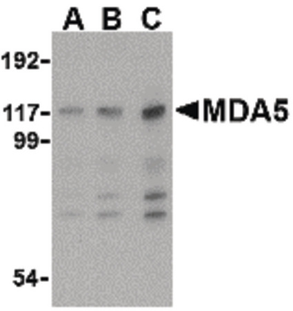Western blot of MDA5 in Daudi cell lysate with MDA5 antibody at (A) 1, (B) 2 and (C) 4 ug/ml.
