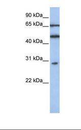 Jurkat cell lysate. Antibody concentration: 1.0 ug/ml. Gel concentration: 12%.