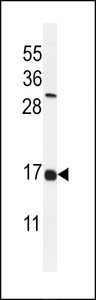 Western blot of IFM2 Antibody in NCI-H460 cell line lysates (35 ug/lane). IFM2 (arrow) was detected using the purified antibody.