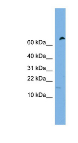 IFITM5 antibody LS-C116279 Western blot of HeLa lysate.