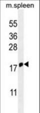 IFITM5 Antibody western blot of mouse spleen tissue lysates (35 ug/lane). The IFITM5 antibody detected the IFITM5 protein (arrow).