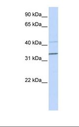 MCF7 cell lysate. Antibody concentration: 1.0 ug/ml. Gel concentration: 12%.
